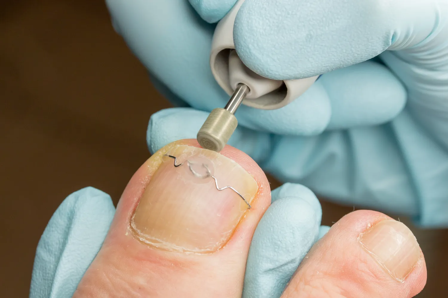 Podologia - co oznacza ten termin?