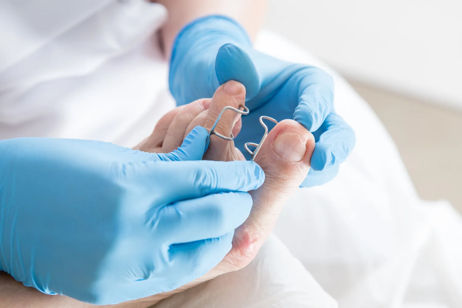 Przygotuj swoje stopy na lato - podologiczne ABC