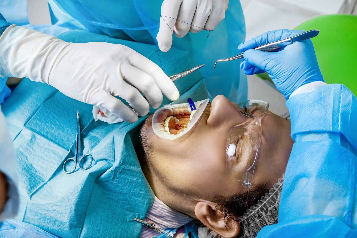 Techniki modelowania ust